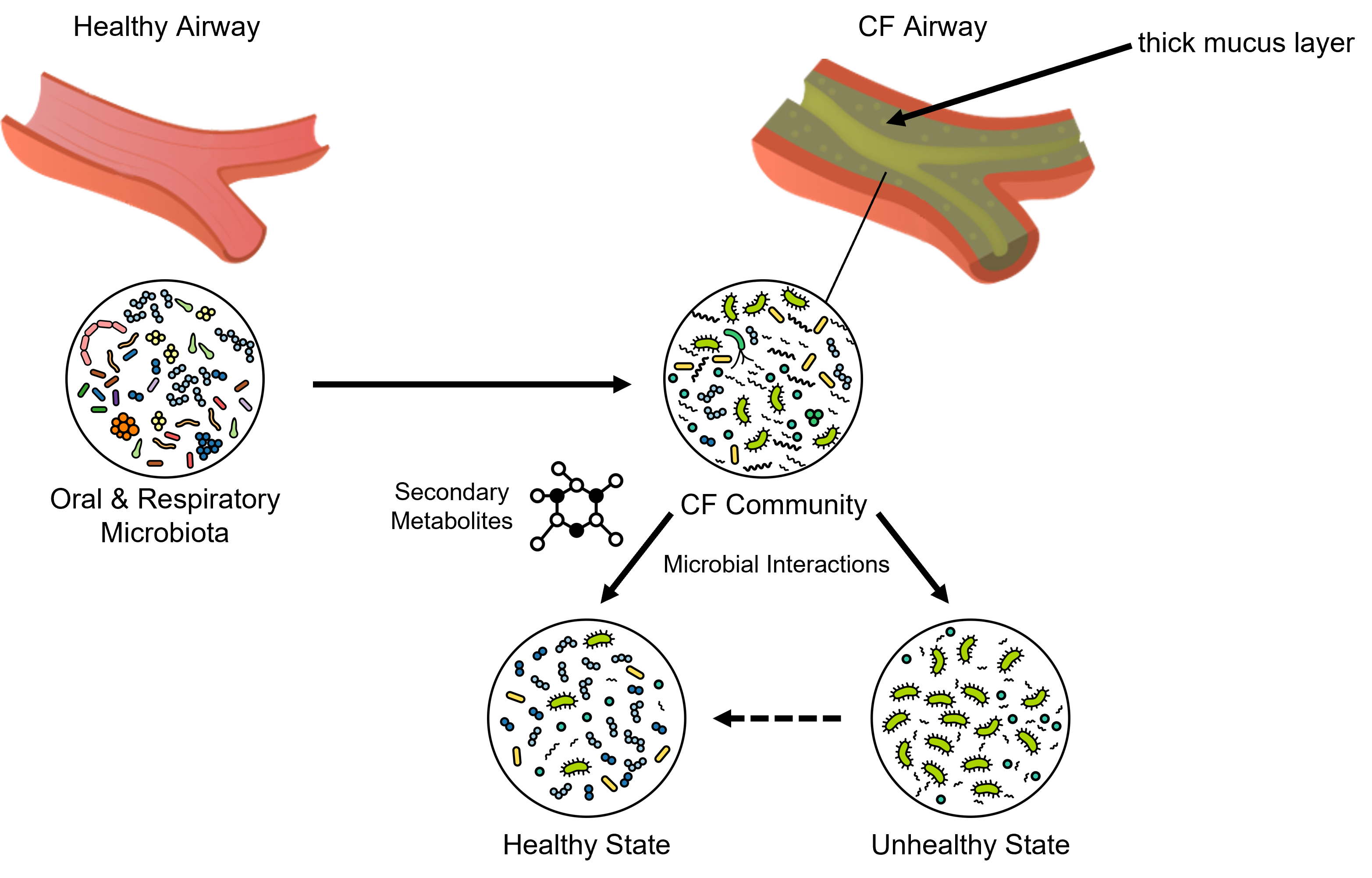 Schematic of bacterial interactions in the cystic fibrosis airway